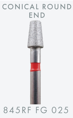 12.12-1430-inlay-onlay-845RF