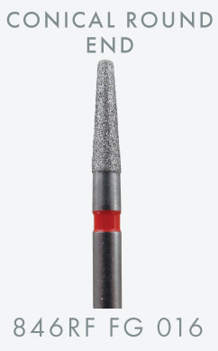 12.12-1430-inlay-onlay-846RF