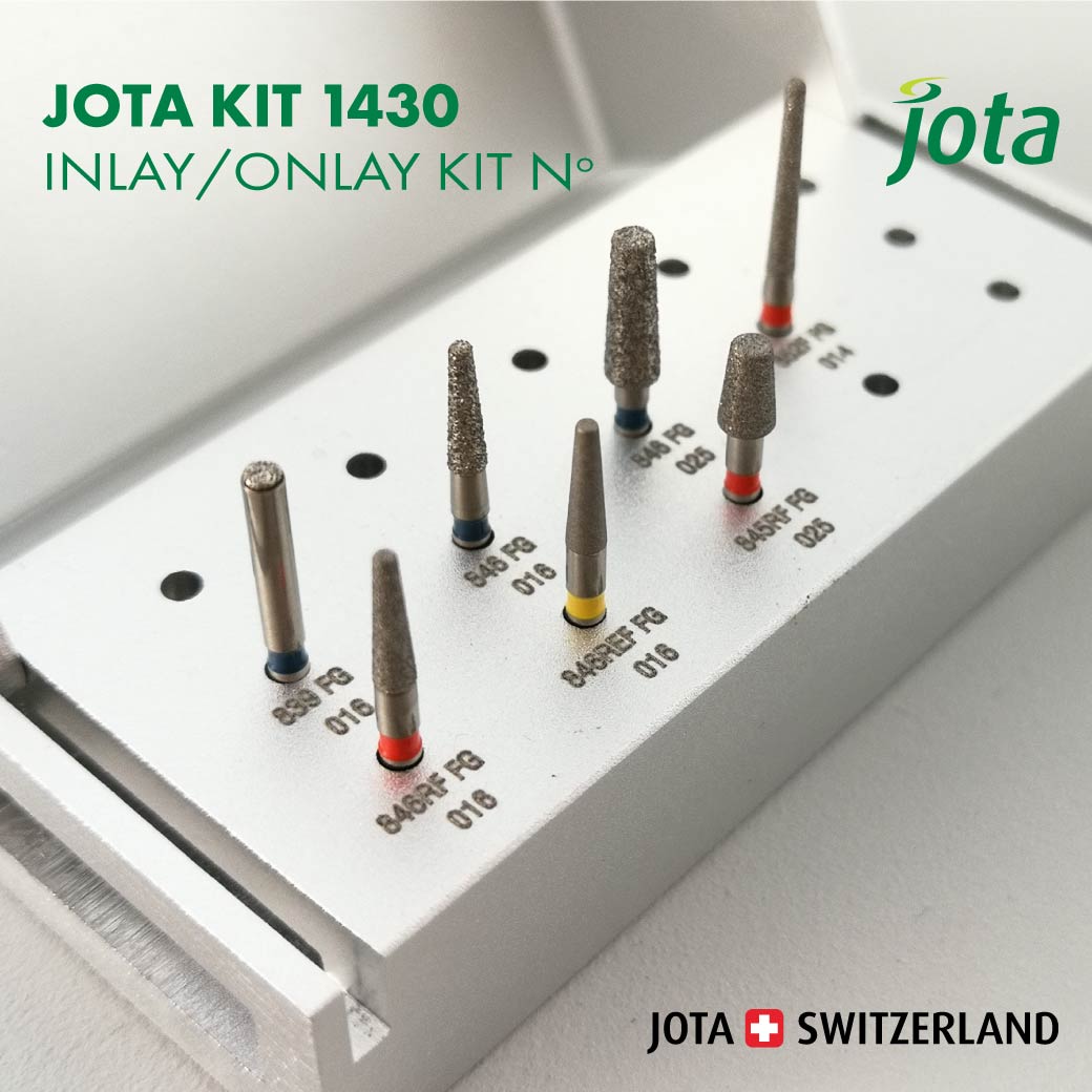 12.12-1430-inlay-onlay-ON-WEB