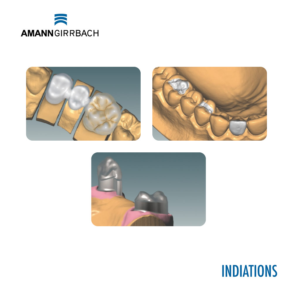 Banner-Ceramill-Mind-CAD-Software-Base-Version2 Banner-Ceramill-Mind-CAD-Software-Base-Version2