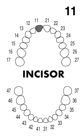 incisor1.1