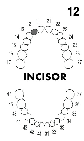 incisor1.2