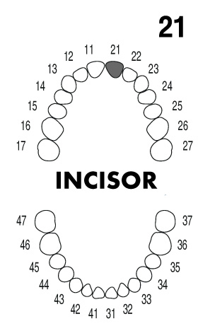 incisor2.1