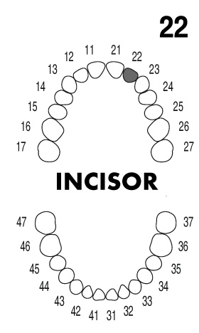 incisor2.2