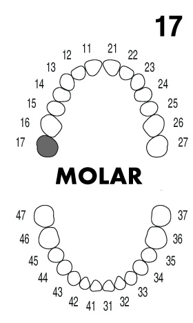 molar1.7