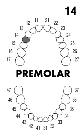 premolar1.4