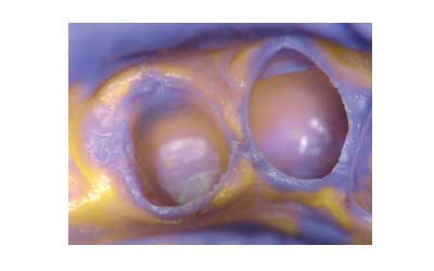 putty3