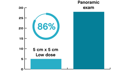 cs-8200-3d-teaser-2---low-dose-graph