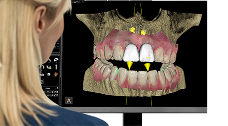 cs-8200-3d-teaser-5---open-solution