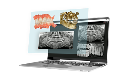 cs-8200-3d-teaser-6---cs-imaging