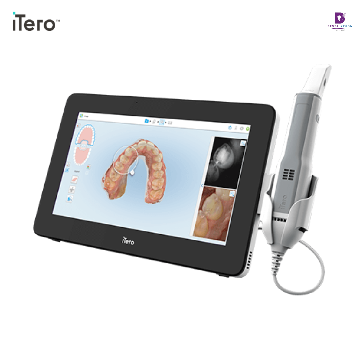ดีไซน์ที่ยังไม่ได้ตั้งชื่อ iTero Element 5D Plus Mobile Configuration